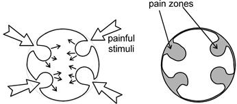 Description: pain zones.jpg